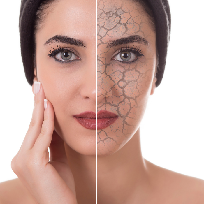 Visage de femme avec un côté la peau sèche et sensible avec une main sur son visage.